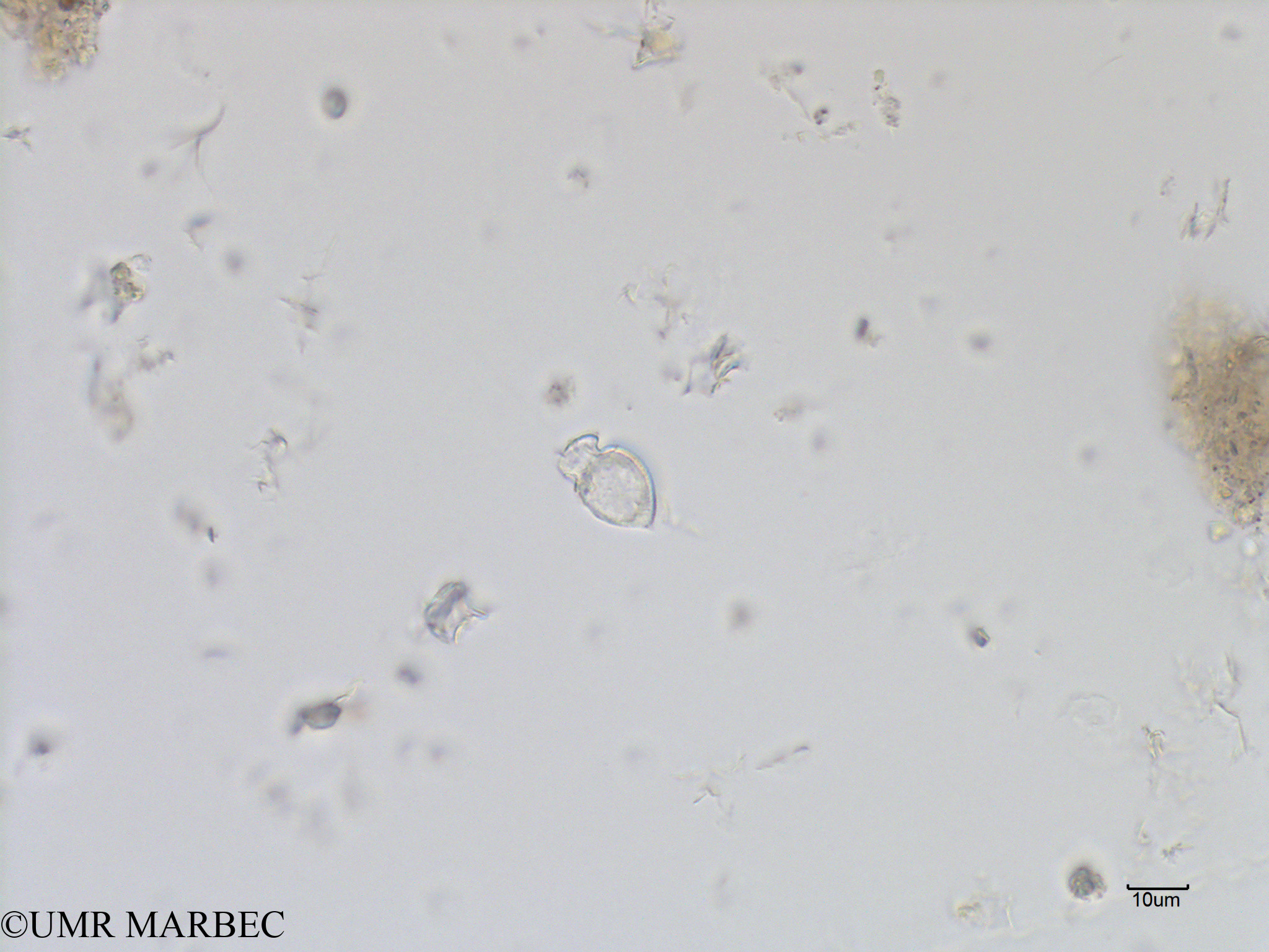 phyto/Bizerte/bizerte_bay/RISCO July 2016/Oxytoxum laticeps (Baie_T1A-cf corythodinium-3).tif(copy).jpg